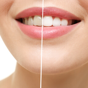 Pearlsmile Pearlsmile